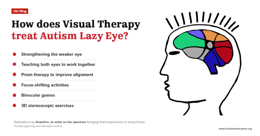 Illustration of a brain highlighting visual areas with a list explaining how visual therapy helps treat autism lazy eye and amblyopia