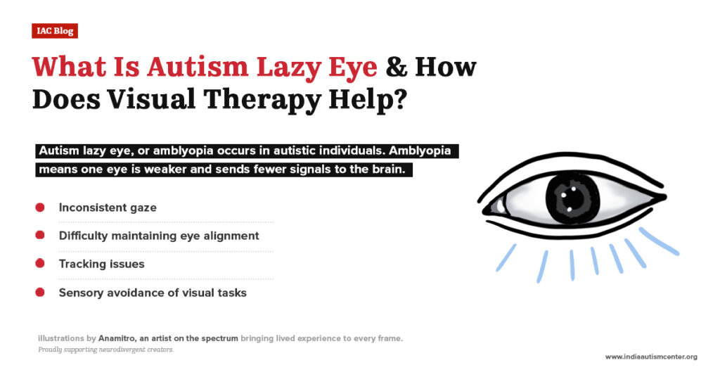 Graphic explaining autism lazy eye (amblyopia) with an illustration of an eye and a list of symptoms like inconsistent gaze and tracking issues